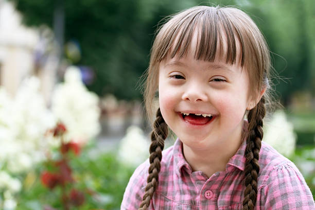 What is Down Syndrome | Child Development Center in Agra