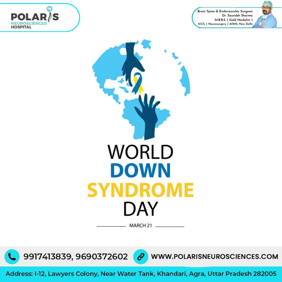 World Down Syndrome Day | Down Syndrome Day Symptoms, Treatment