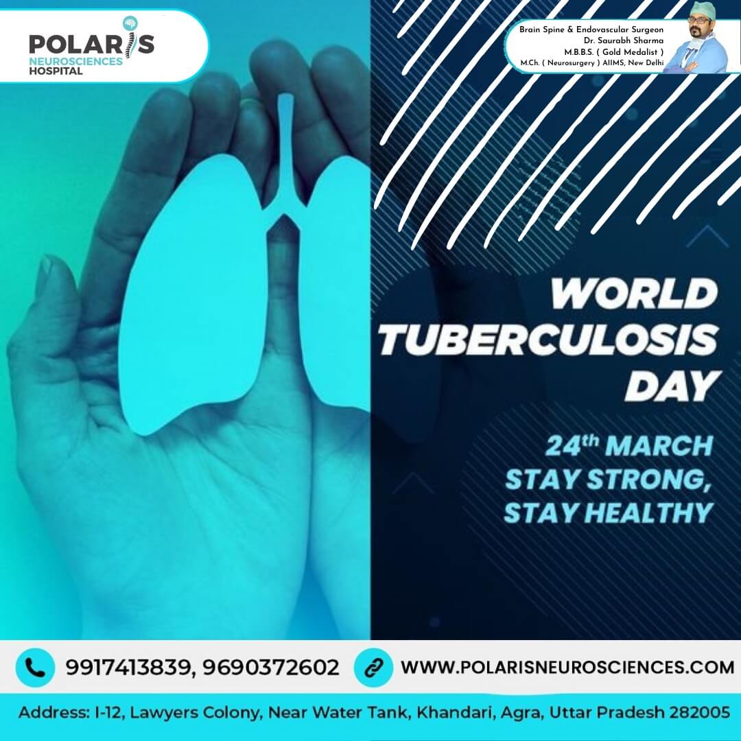 World Tuberculosis Day | Spine TB/Tuberculosis Treatment in Agra