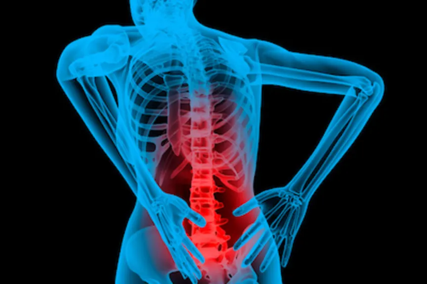 What is Ankylosing Spondylitis | Signs & Treatment