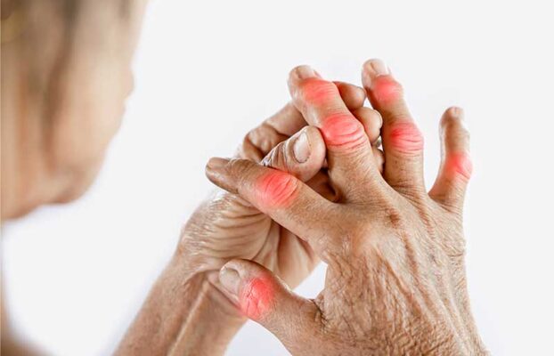 What is Arthritis | Symptoms & Treatment